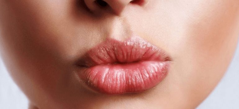 Todo lo que debes saber sobre el aumento y relleno de labios