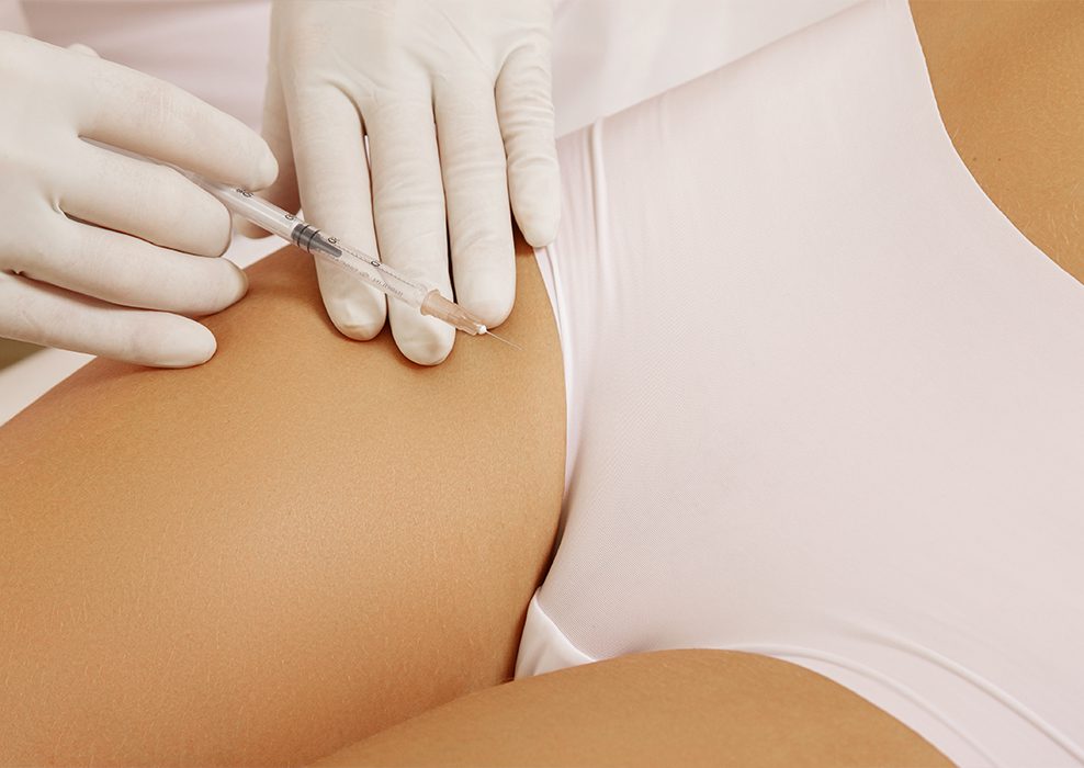 Imagen tratamiento ácido hialurónico vaginal IMR