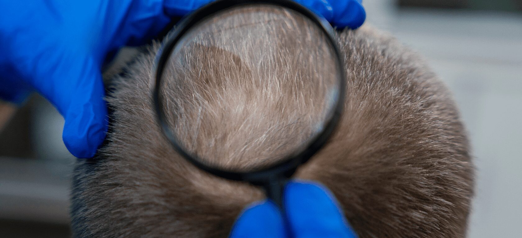 Alopecia difusa