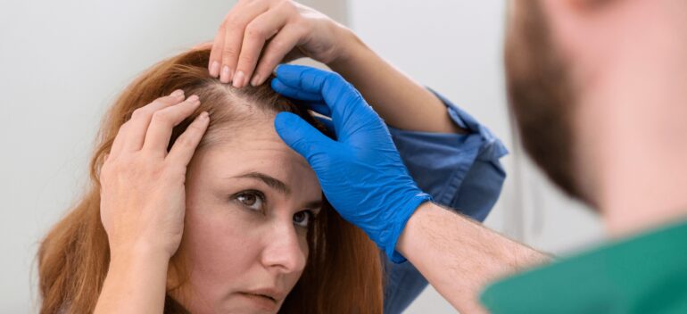 Alopecia Femenina: Tratamientos para combatirla. ¿Puede llegar a afectar la autoestima?