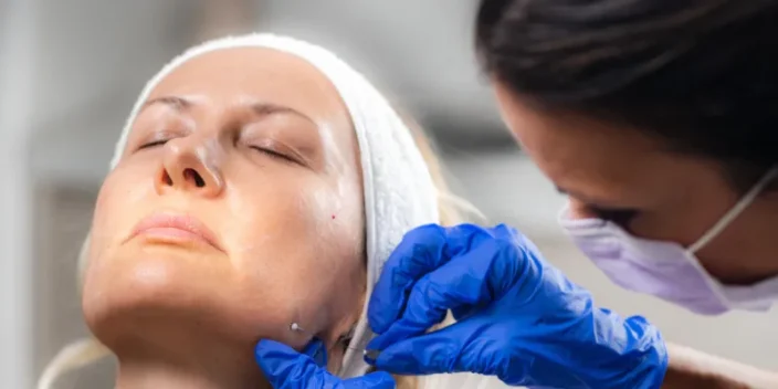 Aumento de pómulos: ¿Cómo lograr una perfecta armonía facial?