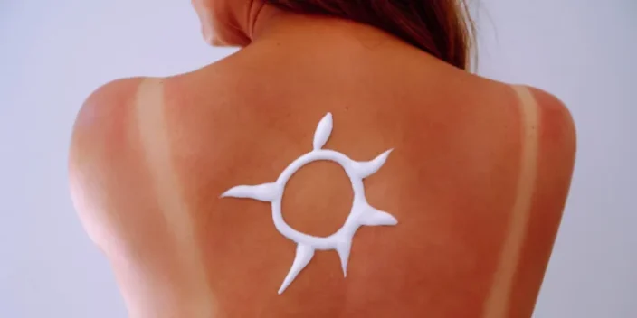 Mancha solar en la piel: 5 claves para identificarla