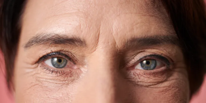 arrugas entrecejo