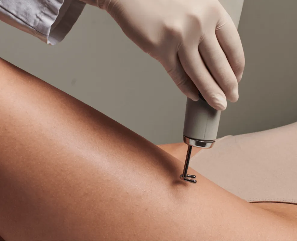 Cirugía vascular Madrid