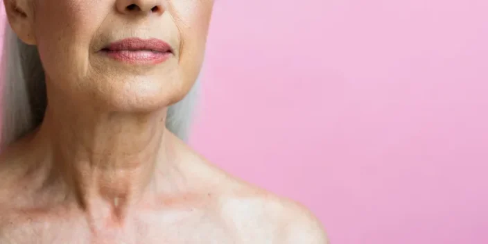 ¿Cómo eliminar la flacidez en el cuello? Tratamientos más efectivos