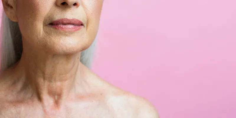 flacidez en el cuello