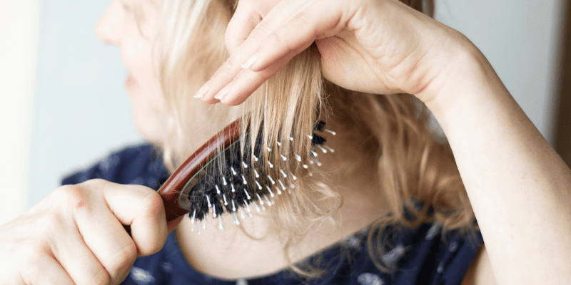 Caida de pelo estacional